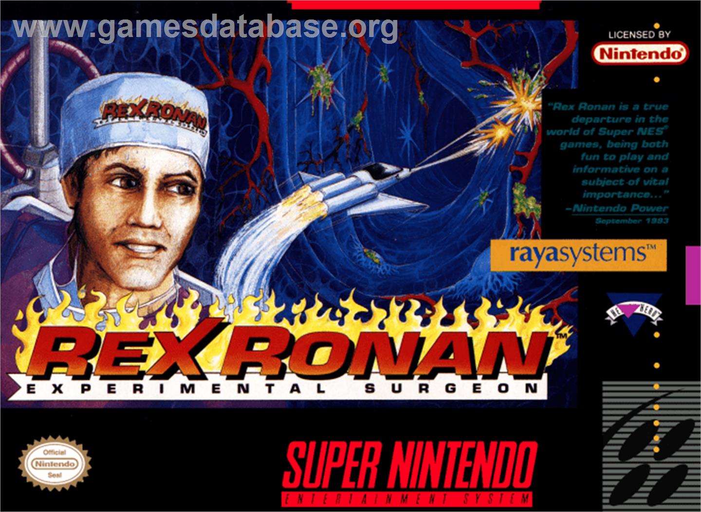 Rex Ronan: Experimental Surgeon - Nintendo SNES - Artwork - Box