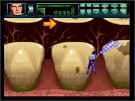 In game image of Rex Ronan: Experimental Surgeon on the Nintendo SNES.