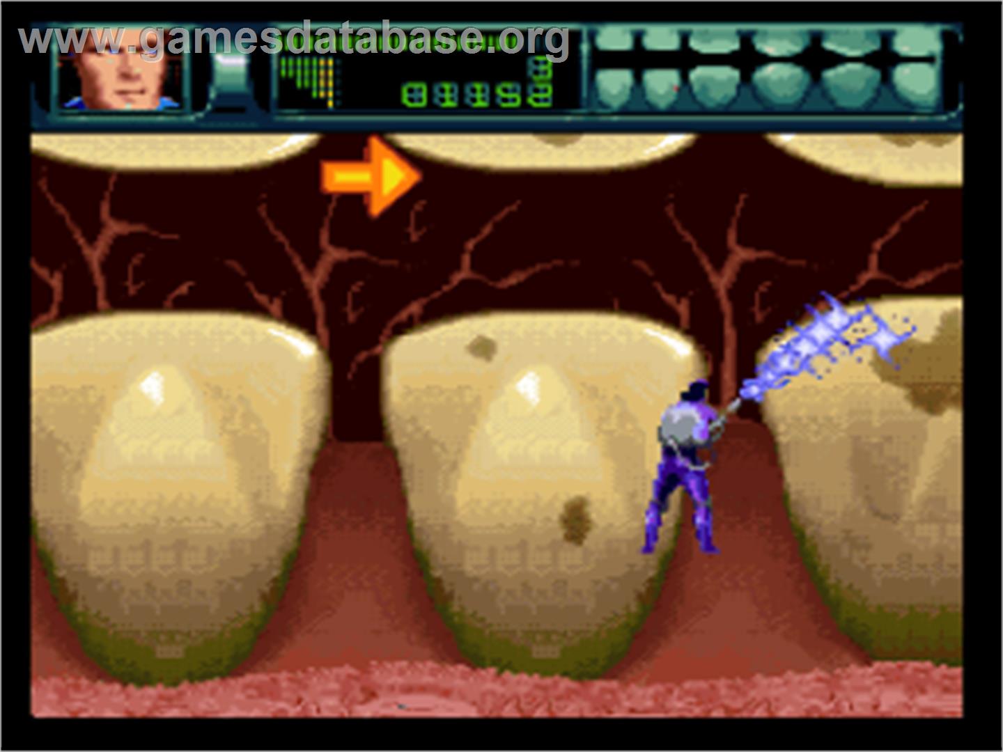 Rex Ronan: Experimental Surgeon - Nintendo SNES - Artwork - In Game